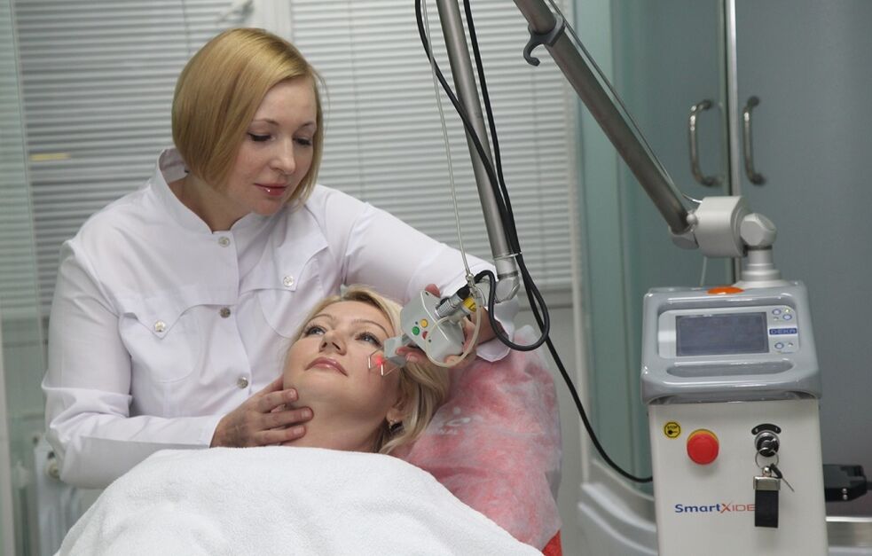 fractional skin rejuvenation laser procedure