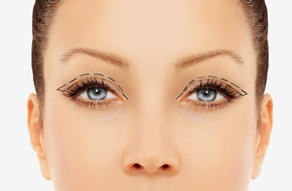 Outline of the eyelid
