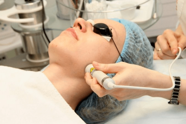 Laser biorevitalization