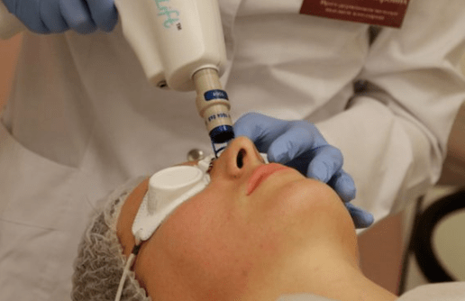 Unpurchase laser rejuvenation